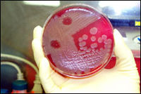 200px-anthrax_01.jpg