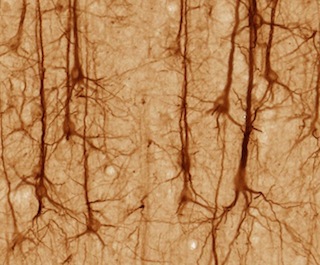 Smi32neuron